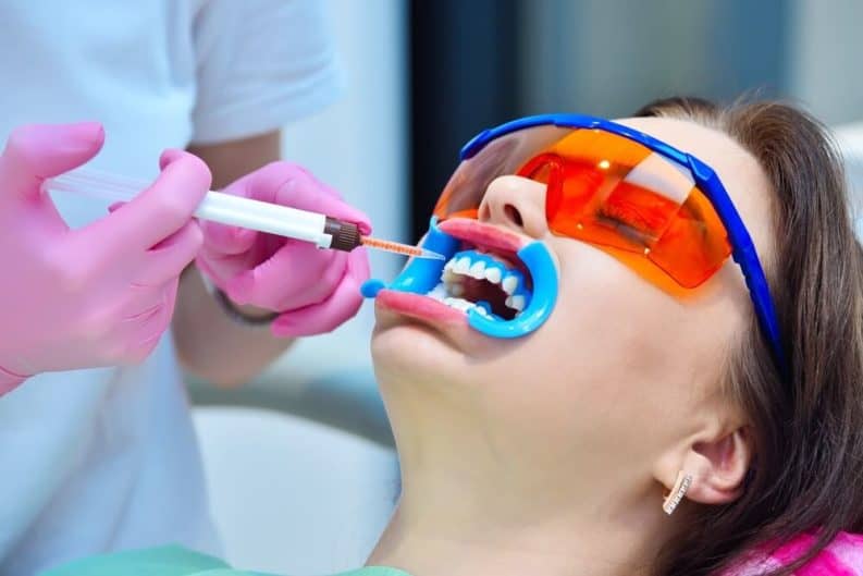 Get a brighter smile in minutes with instant results whitening Blackburn