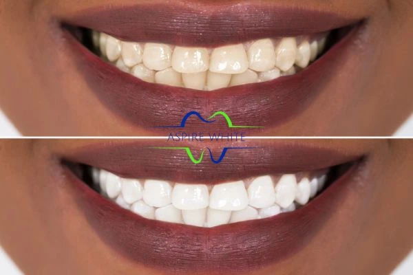 Side-by-side comparison showing before and after results of a cosmetic treatment Blackburn