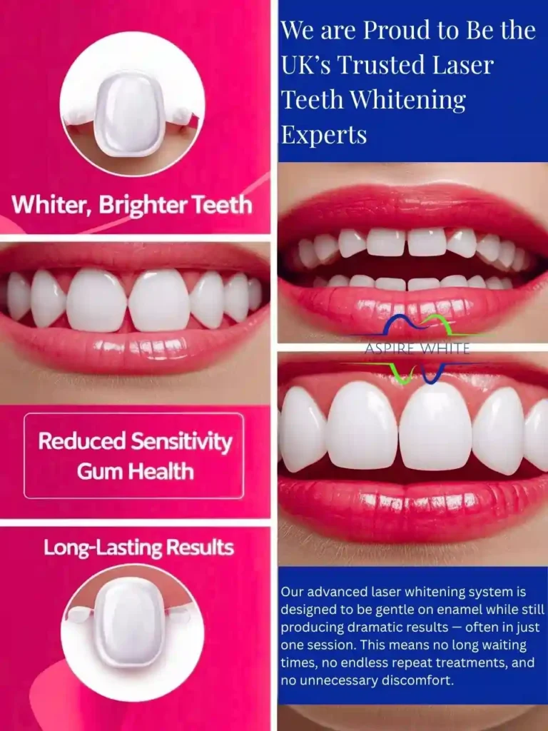 We are Proud to Be the UK’s Trusted Laser Teeth Whitening Experts Blackburn